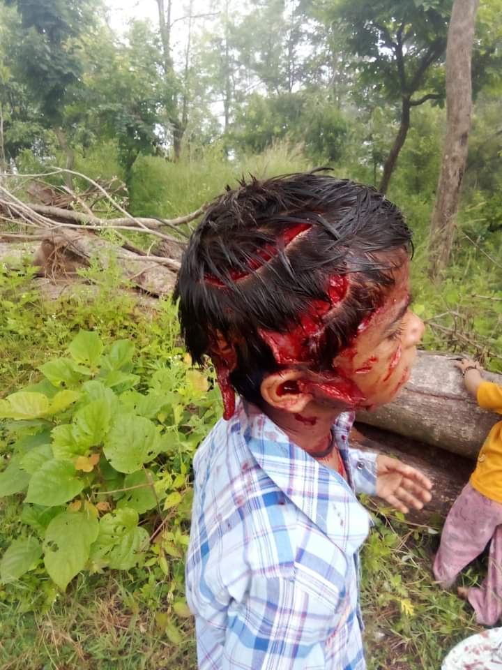 ठांगर गांव में बच्चे को गुलदार ने घायल किया